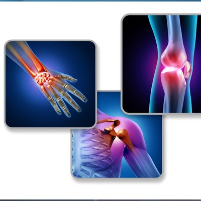 What is Arthritis? - Pranaam Hospitals