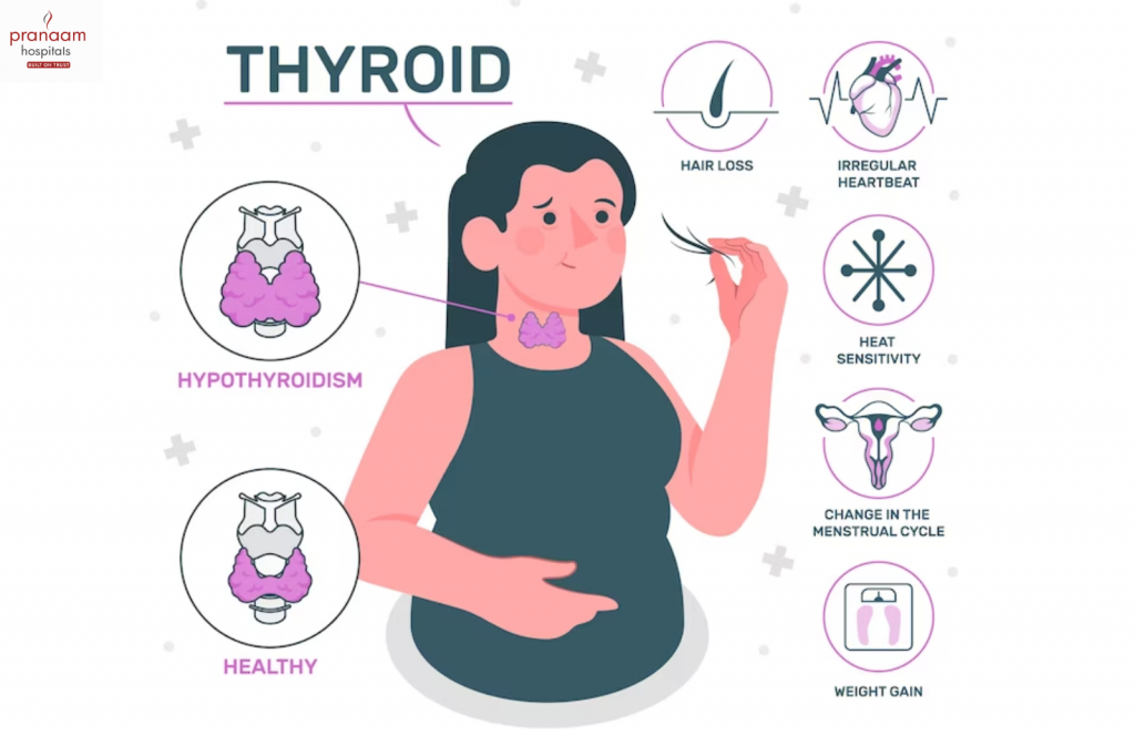 Hypothyroidism